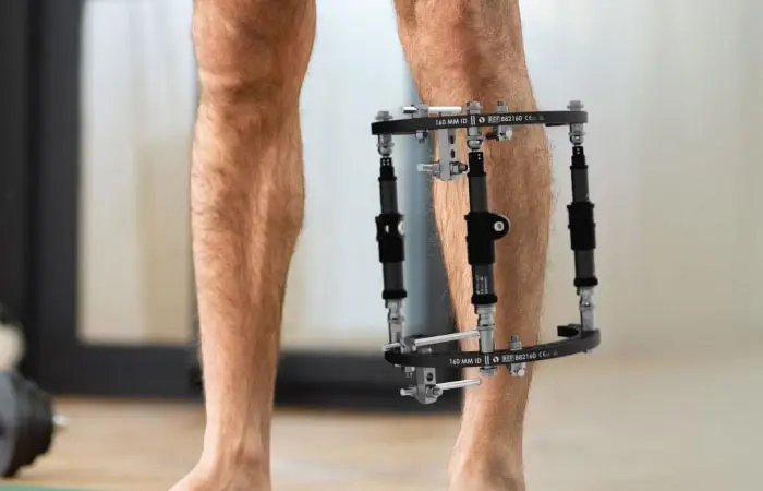 Sports Injury